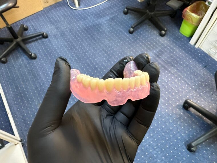 Proteză acrilică pe model de lucru, tehnică dentară Iași