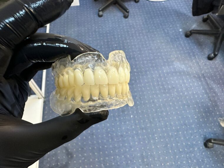 Proteză transparentă Bio Dentoplast pentru persoane sensibile