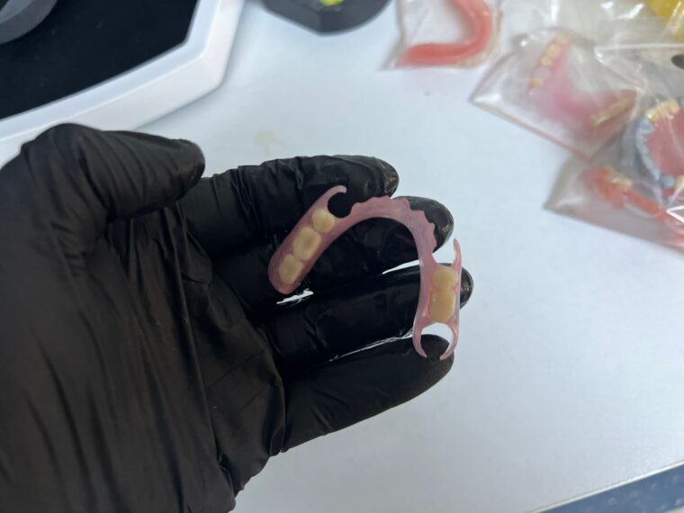 Proteză dentară elastică, flexibilă, fără cârlige metalice vizibile