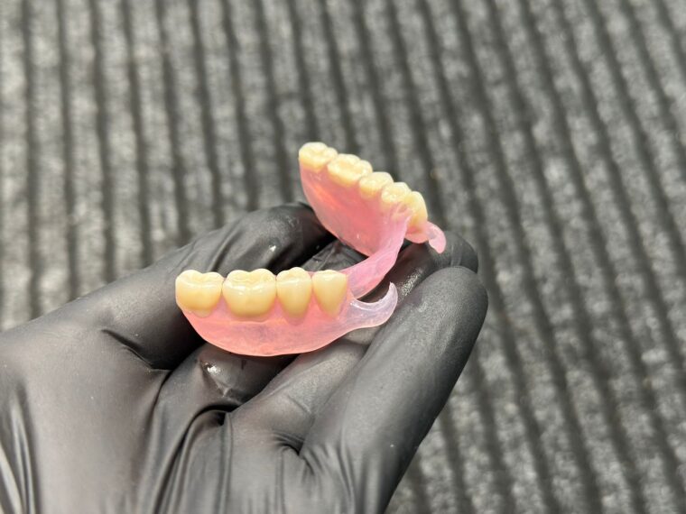 Proteză elastică pentru arcada inferioară, Yess Dental Iași