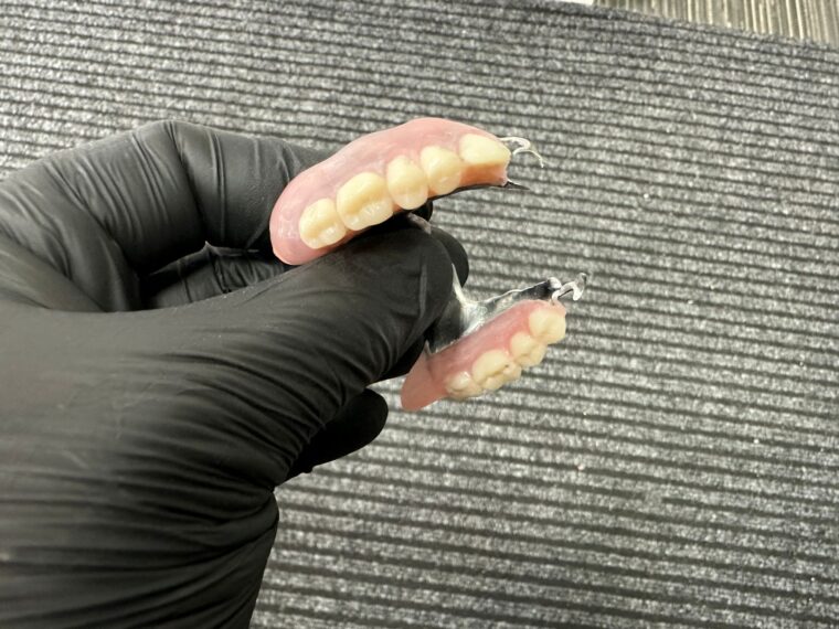 Schelet metalic al protezei scheletate, tehnică dentară Iași